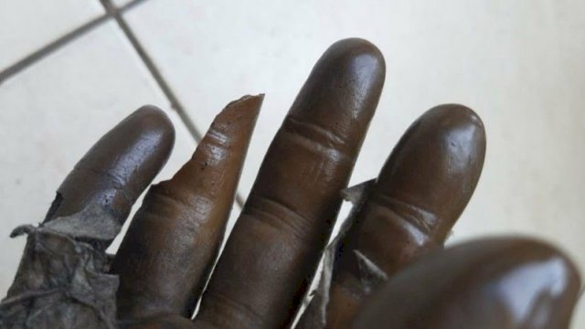 Liput Kepulangan Ahmad Dhani, Jari Wartawan Putus