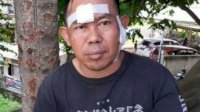 Agus : Salah Satu Pelaku Bilang Sudah Kita Salah Sasaran