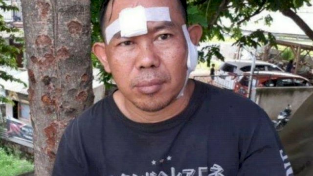 Agus : Salah Satu Pelaku Bilang Sudah Kita Salah Sasaran