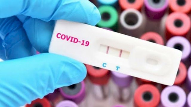 316 Warga Makassar di Nyatakan Positif Hasil Rapid Test