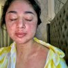 Spesialis Penyakit Dalam Sebut Penyakit DP Adalah Efek dari Covid-19 yang Menyerang Organ Tubuh