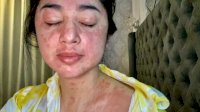 Spesialis Penyakit Dalam Sebut Penyakit DP Adalah Efek dari Covid-19 yang Menyerang Organ Tubuh