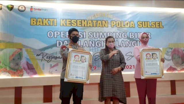 Peduli Kemanusiaan, Polda Sulsel-Smile Train Indonesia Gelar Operasi Bibir Sumbing