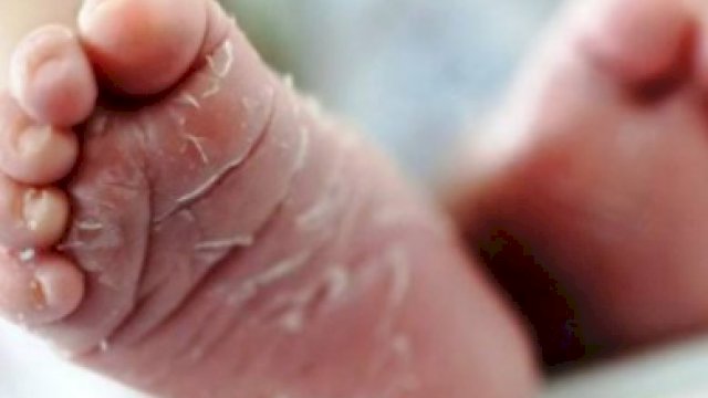 Kaki bayi, (Ilustrasi)