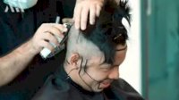 Atta Halilintar Tanam Rambut di Turki Gegara Dahinya Botak Alasannya Kebanyakan Berpikir, Aurel Malah Bilang Begini
