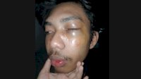 Seorang Mahasiswa di Makassar Babak Belur saat Ikut Aksi&nbsp;
